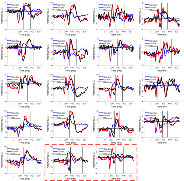 File:P300 response of different subjects.png