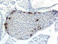 Pancreatic polypeptide