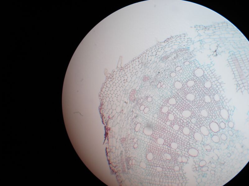 File:Xylem.jpg