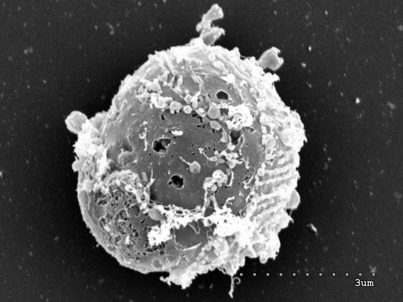 File:Corallochytrium limacisporum.png