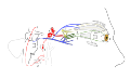 Illustration of Horner's Syndrome and autonomic innervation of the eye, including the ciliary ganglion.