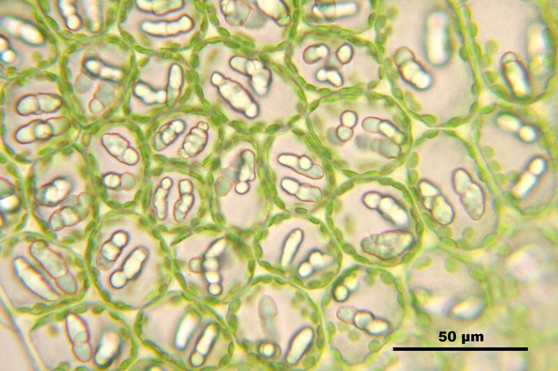 File:Nardia scalaris Blattzellen IMG 8353.jpg
