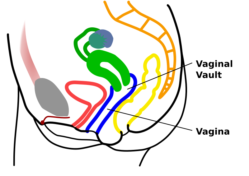 File:Vaginal-vault.svg