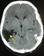 Thumbnail for version as of 03:25, 5 June 2026