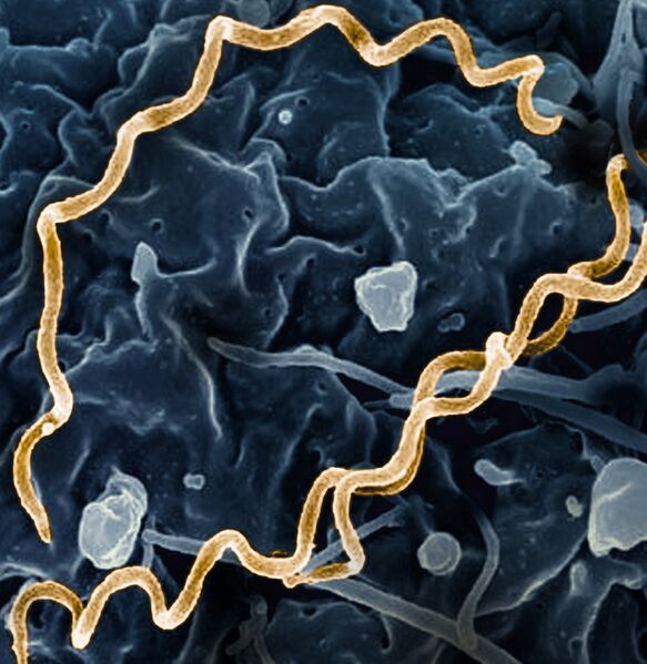 File:Treponema pallidum Bacteria (Syphilis) (cropped).jpg