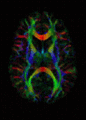 Thumbnail for version as of 12:51, 29 May 2026