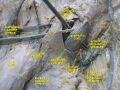 Inguinal canal