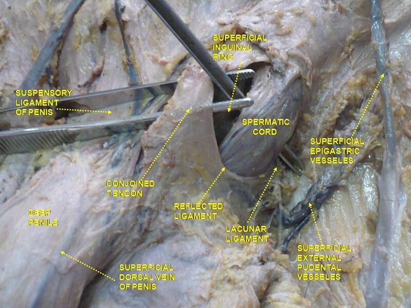 File:Slide4Nemo.JPG