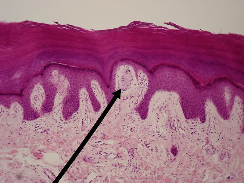 File:WVSOM Meissner's corpuslce.JPG