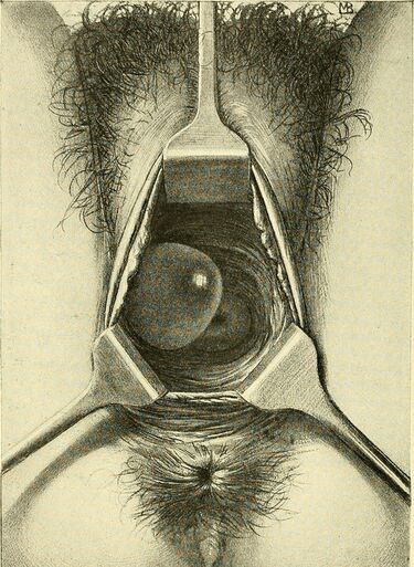 File:Operative gynecology - (1906) (14781201664).jpg