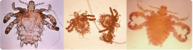 File:Crab Lice CDC.png