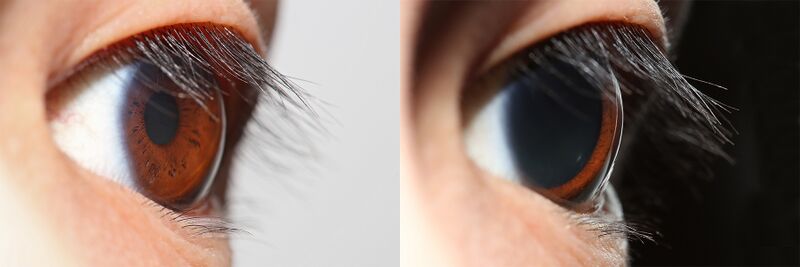 File:Pupillary light reflex.jpg