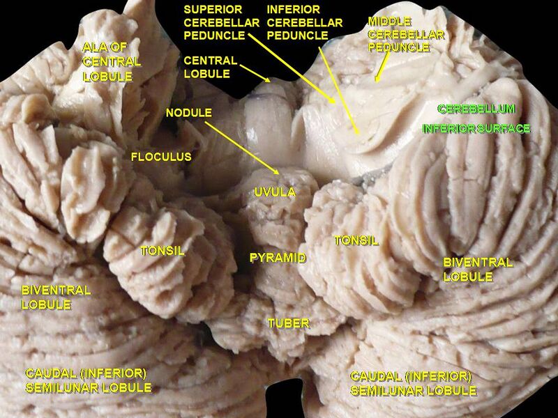 File:Slide4SER.JPG