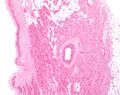 Sinoatrial node low magnification
