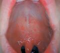 Thumbnail for version as of 03:23, 5 June 2026
