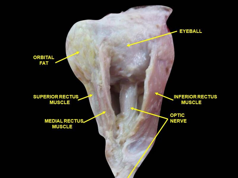 File:Slide2abaa.JPG