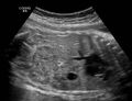 Thumbnail for version as of 12:50, 29 May 2026