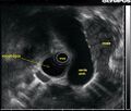 Thumbnail for version as of 03:23, 5 June 2026