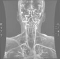 Thumbnail for version as of 12:51, 29 May 2026