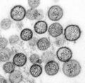 Sin Nombre virus Hanta TEM 1137 lores