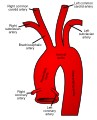 Diagram of the aortic arch and its branches