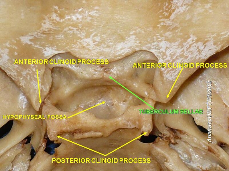 File:Slide1iiii.JPG