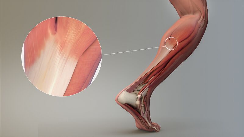 File:Magnified view of a Tendon.jpg