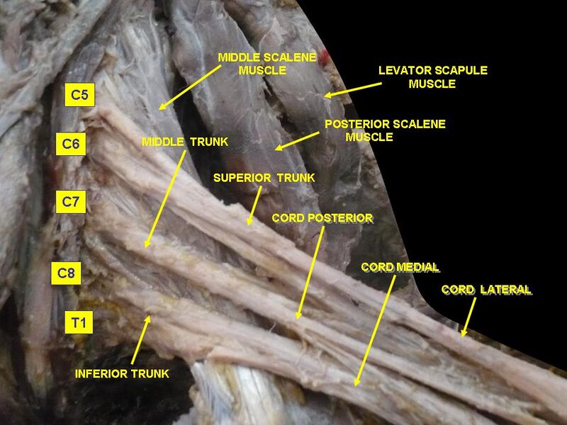 File:Slide1cord.JPG