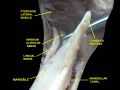 Lingual nerve