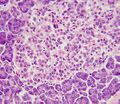 Alpha cell