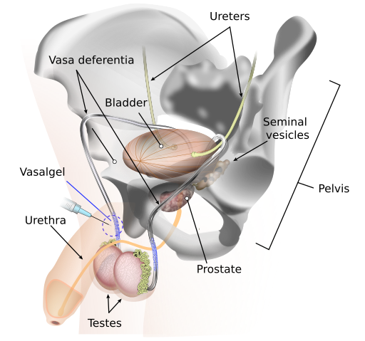 File:Vasalgel diagram.svg