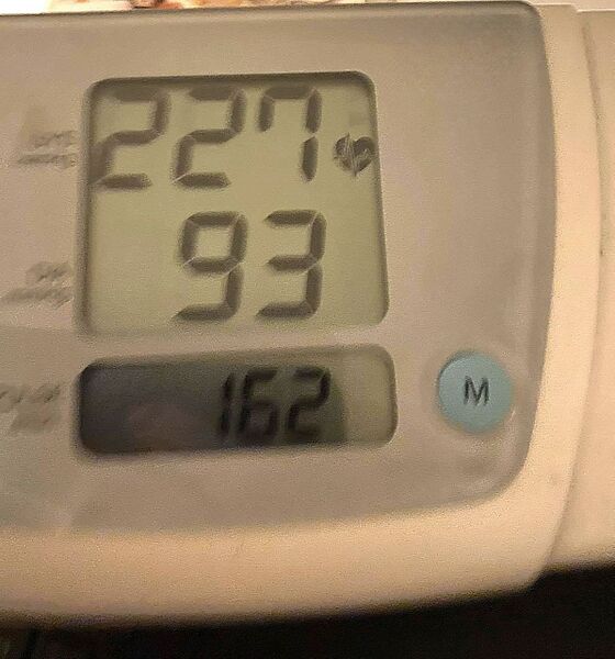 File:227 over 93 hypertension.jpg
