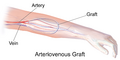 Thumbnail for version as of 03:29, 5 June 2026