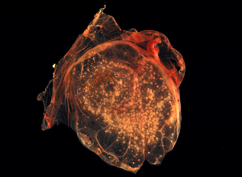 File:Smallpox CAM.png