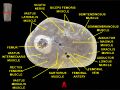 Muscles of thigh. Cross section.