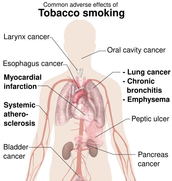 File:Adverse effects of tobacco smoking-outl.svg