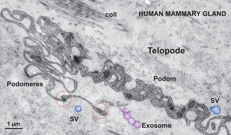 File:Telocytes - Fig 4.jpg