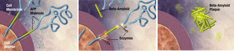 File:Amyloid-plaque formation-big.jpg