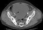 Thumbnail for version as of 22:26, 8 June 2026