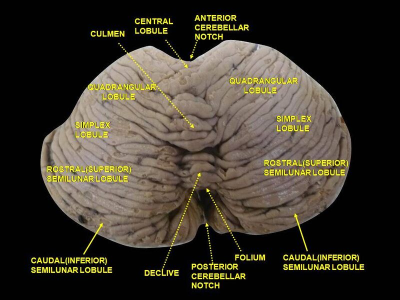 File:Slide2AST.JPG