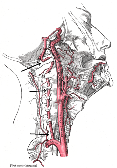 File:Vertebral artery.png